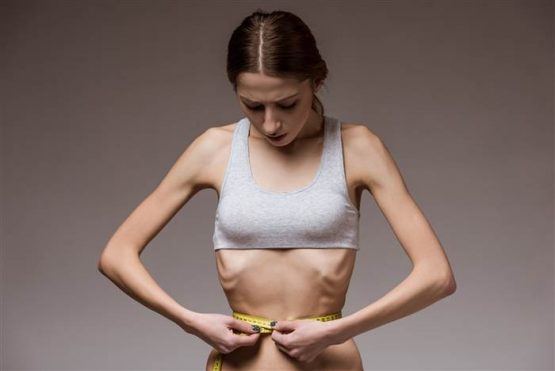 anorexia