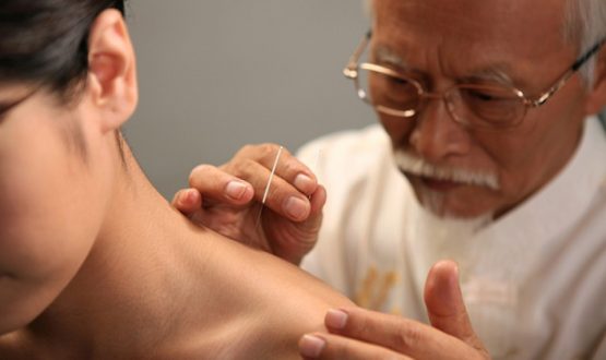 acupunctura 1