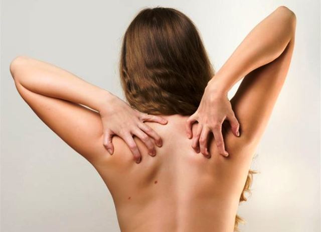 eczema