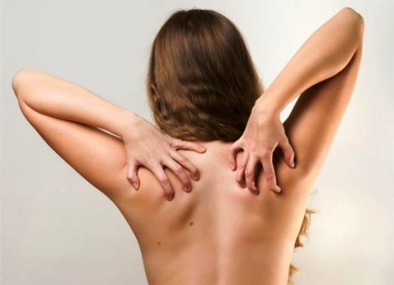 eczema